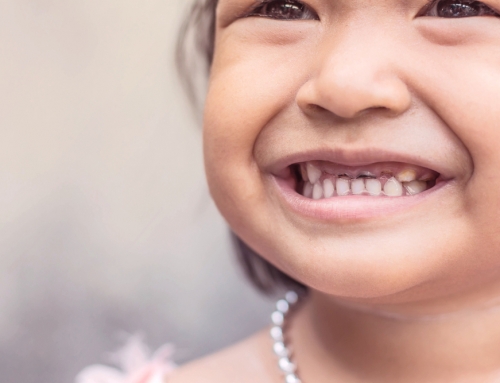 Gaps Look Cute In Children’s Teeth: But Not Adults!